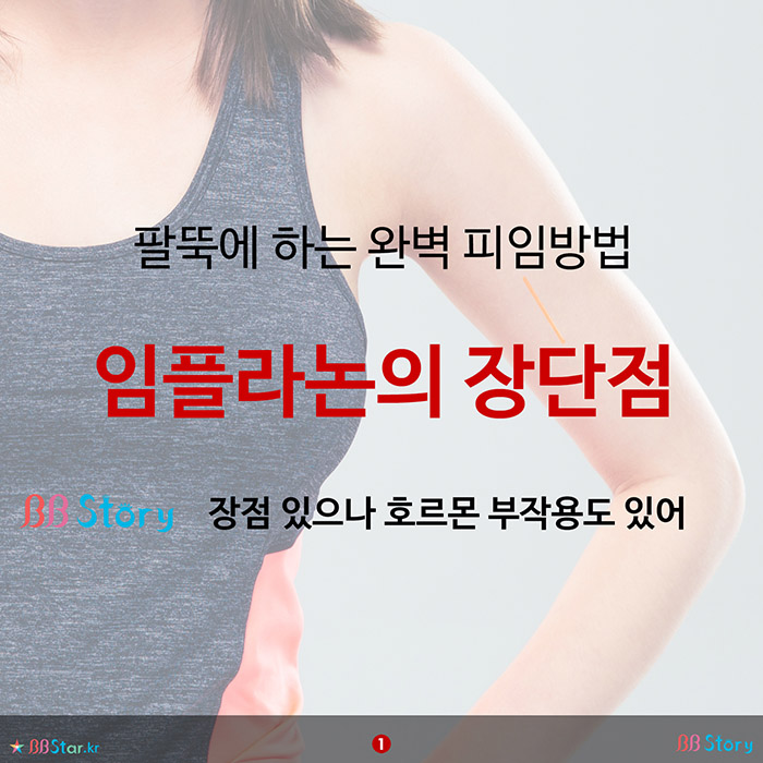 비비스토리, BBStory, 팔뚝에 하는 완벽 피임방법, 임플라논의 장단점