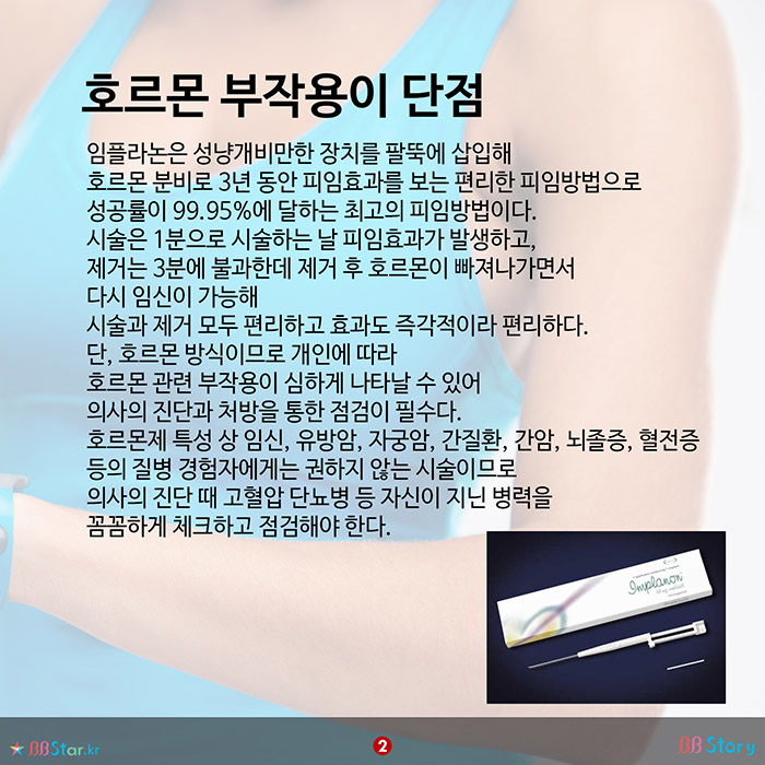 비비스토리, BBStory, 팔뚝에 하는 완벽 피임방법, 임플라논의 장단점 호르몬 부작용이 단점