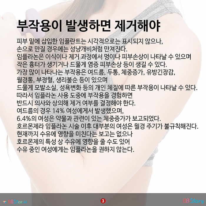 비비스토리, BBStory, 팔뚝에 하는 완벽 피임방법, 임플라논의 장단점 임플라논 부작용이 발생하면 제거해야